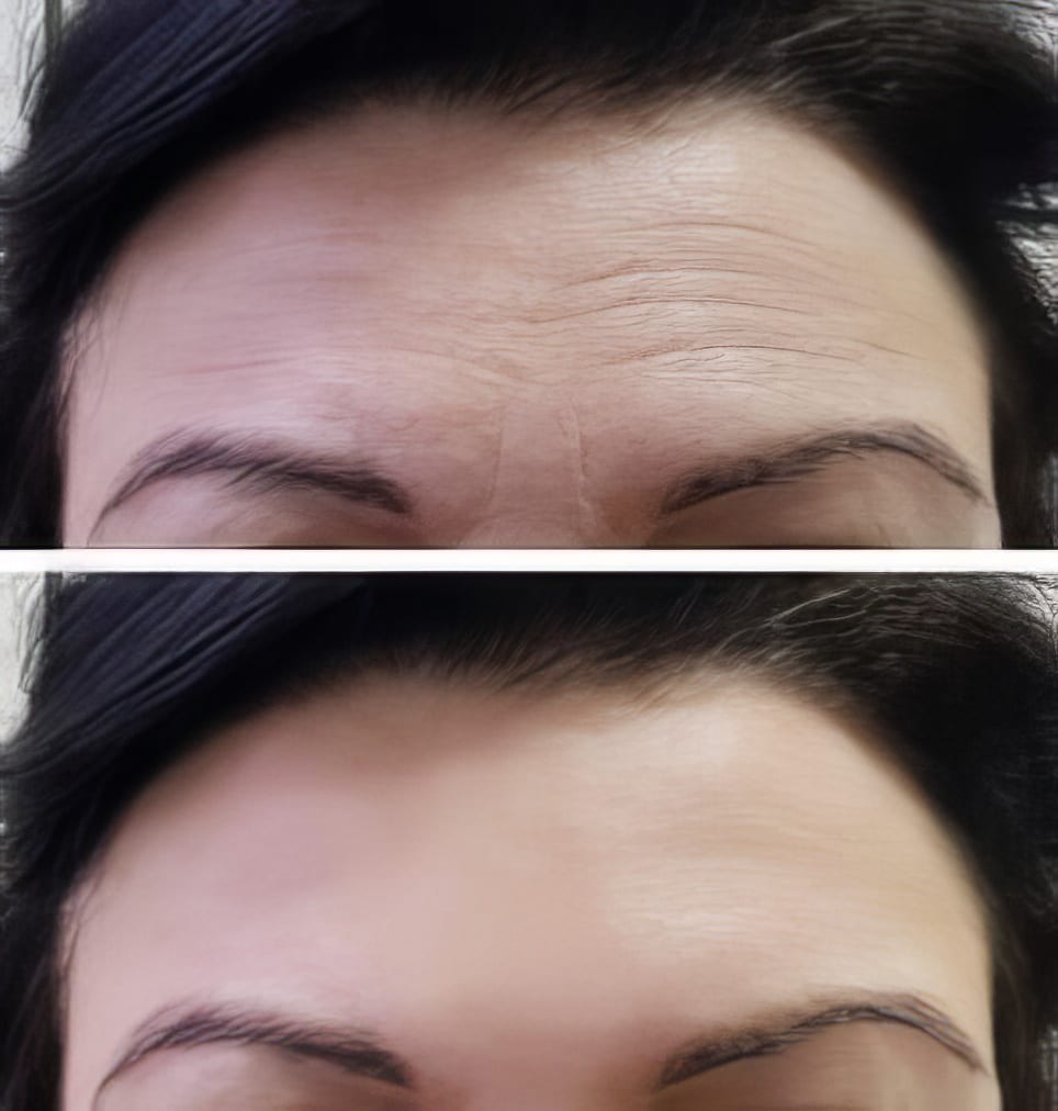Before and After Image: Case Four - front